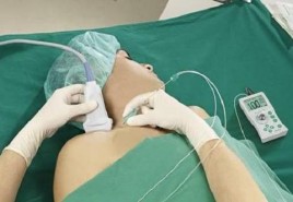 Uso de ultrassonografia em anestesia